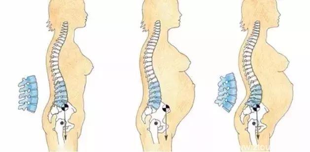 生孩子后，你的腰为何“未老先衰”？来看看腰疼的根源在哪？