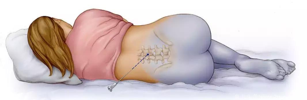 怀孕、带孩子竟然这么伤腰！产后腰痛难忍怎么办？教你3就缓解