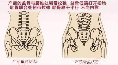 医生说；产后坐月子，这几点不能忽视，否则你的42天月子白做