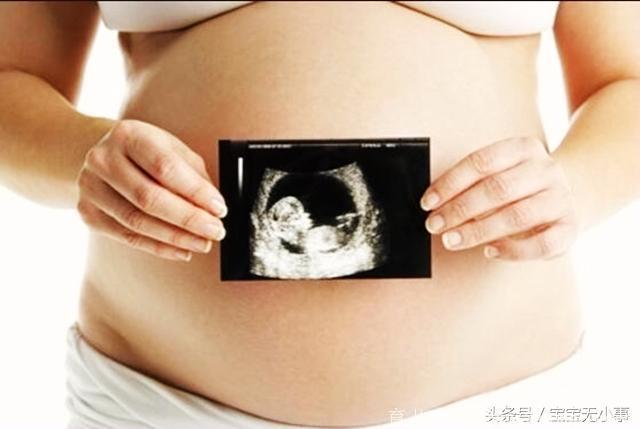 这6类女性怀孕前要想清楚，怀唐氏儿的可能性比较大