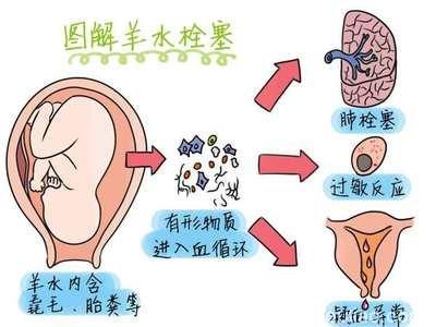 产后的1至2小时很关键，千万别忽视这些情况！