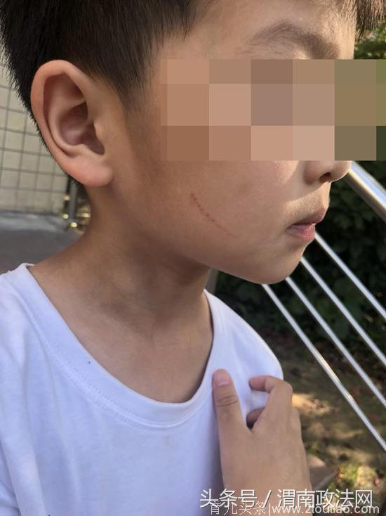 上海一幼儿园保育员划伤4名儿童 已被刑事拘留