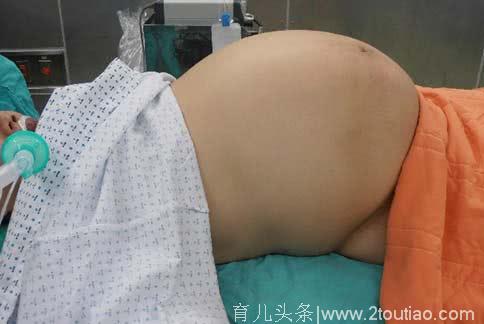 产后三个月肚子突然变大，全家喜迎二胎，但孕妇差点有生命危险！