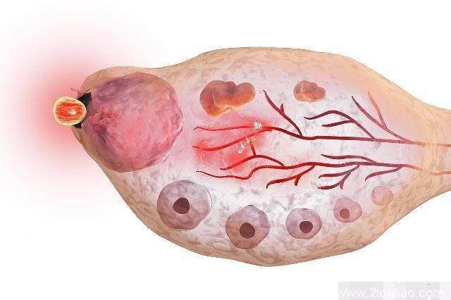 备孕女人别错过，这4类食物有效“促排卵”，着急怀孕的要多吃！