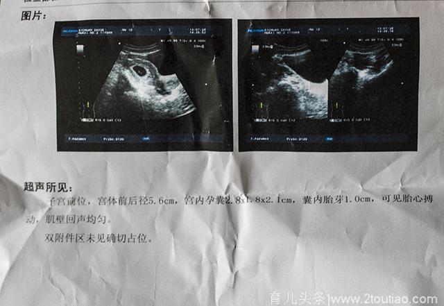 单位体检拍片后十天“中招”怀孕！这个宝宝到底能不能要？