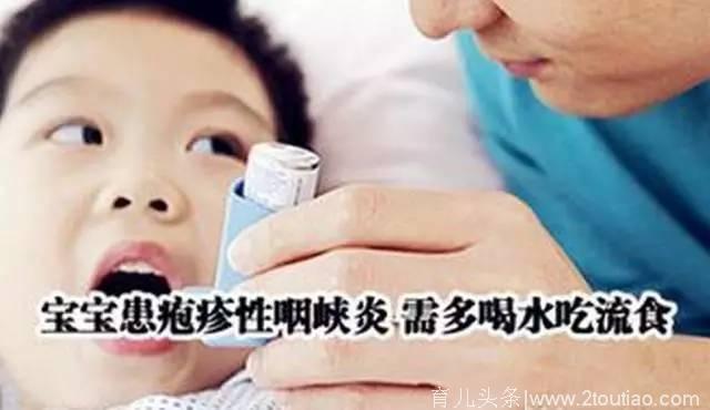 幼儿患疱疹性咽峡炎，比手足口病还厉害！（转给家长）