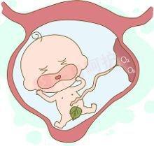 宝宝出生后，不管顺产还是剖腹产，坚持八方面，产后又一次重生