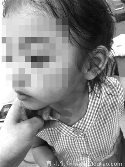 宁波警方通报“家长护犊掌掴对方小孩”：打人者已被行拘