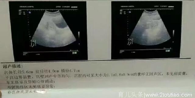 与老公备孕成功，刚怀孕会做什么检查呢