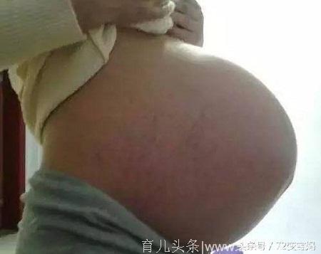 孕妇顺产生下女宝宝，9天后再次被推进产房，宝宝出生后老公哭了
