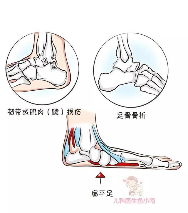 给娃买鞋不能光图好看！医生提醒：穿这种鞋子会影响宝宝长个发育