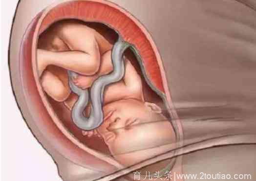 胎儿那么大，是怎么从那么小的产道里生出来的？