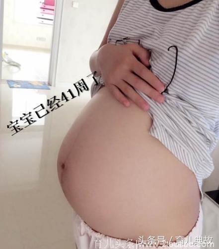 怀孕41周了，是要瓜熟蒂落还是直接去剖腹产？好纠结啊！