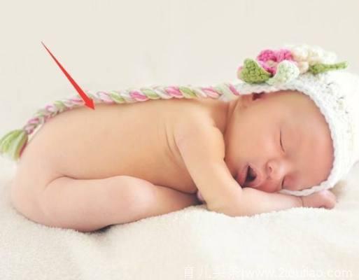 宝宝身上最有福气的4个胎记，你家宝宝身上有没吗？