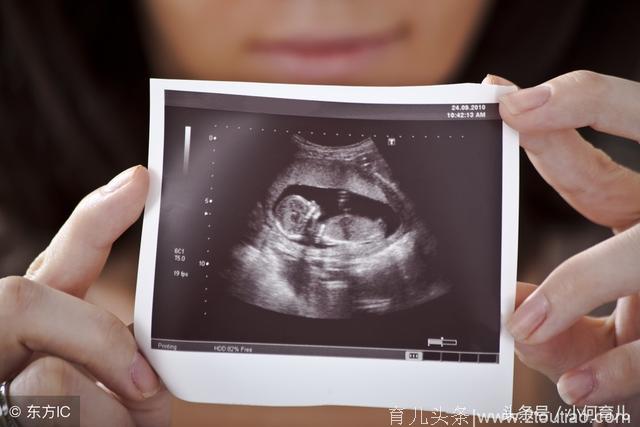 孕期别穿这3种衣服，对胎宝宝不好，还会影响产后哺乳