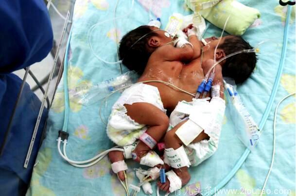 28岁孕妇崩溃了，怀了7个月的双胞胎被迫打掉，看到孩子后大哭