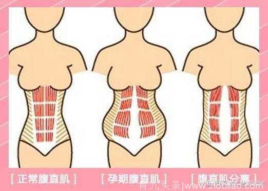 产后如何减肥才能不影响母乳