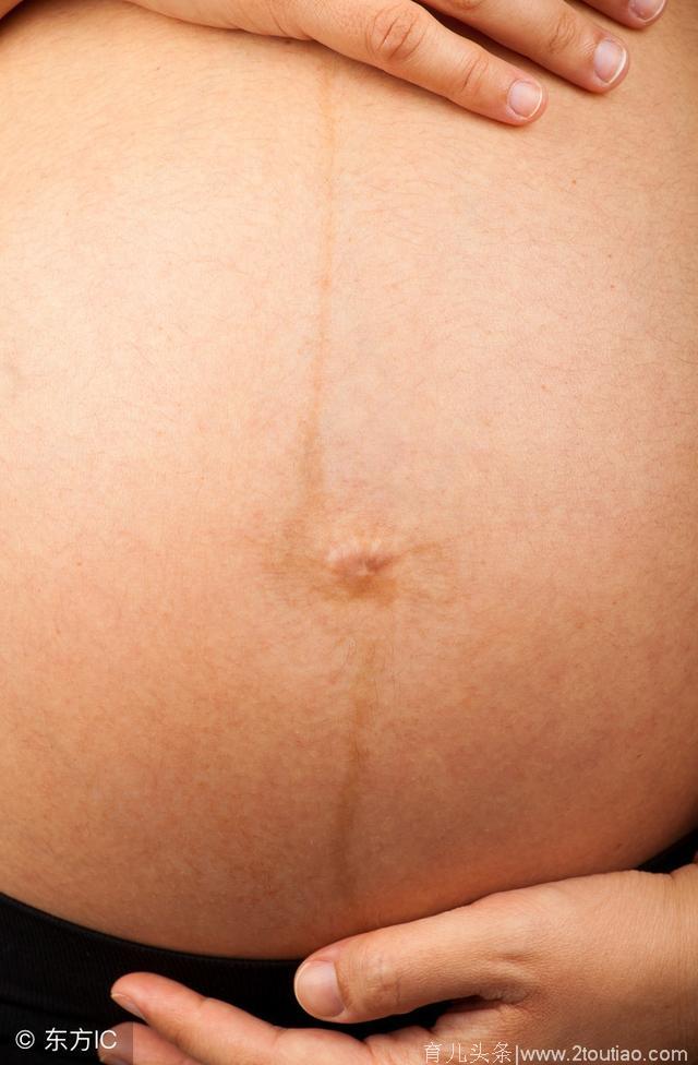 怀孕后，肚皮上为何会爬上一条线？