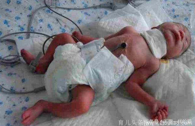 新生婴儿被遗弃在厕所，孩子送到医院后，所有人都惊讶了！