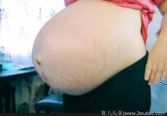 孕妈妈奇形怪状的肚子，让人叹服！做女人不易做妈妈更难