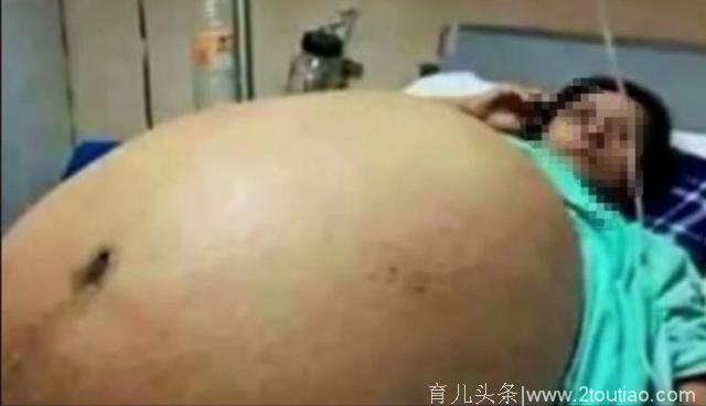 孕妈妈奇形怪状的肚子，让人叹服！做女人不易做妈妈更难