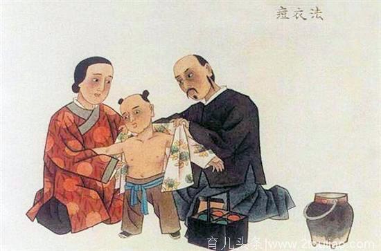 世界最早的免疫方法，中国的发明——人痘接种术