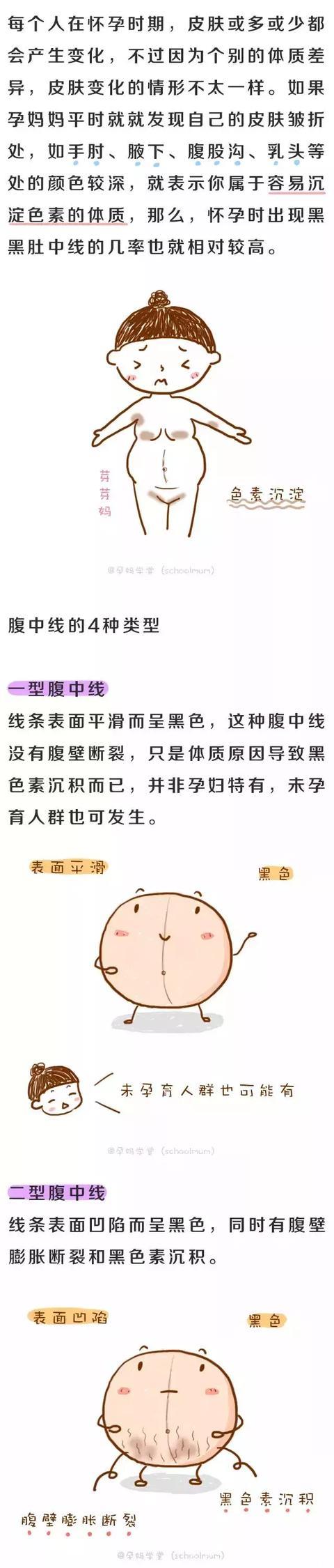 为什么怀孕以后，孕妈妈的肚子上会出现一条黑黑的线？