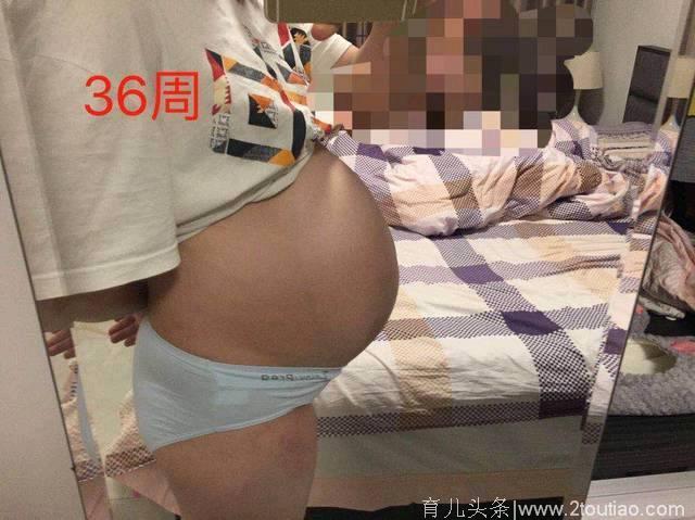 40+6 剖腹产男宝，分享孕期男孩症状，胎梦很准