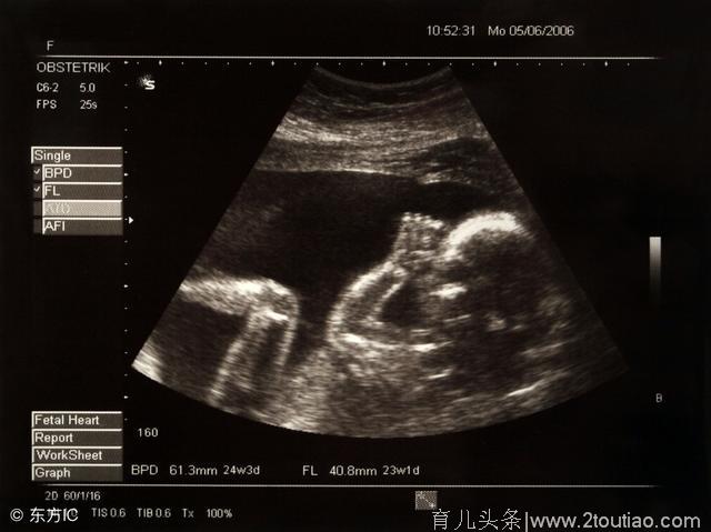 两个胎儿的神秘对话：分娩后我们会怎样？