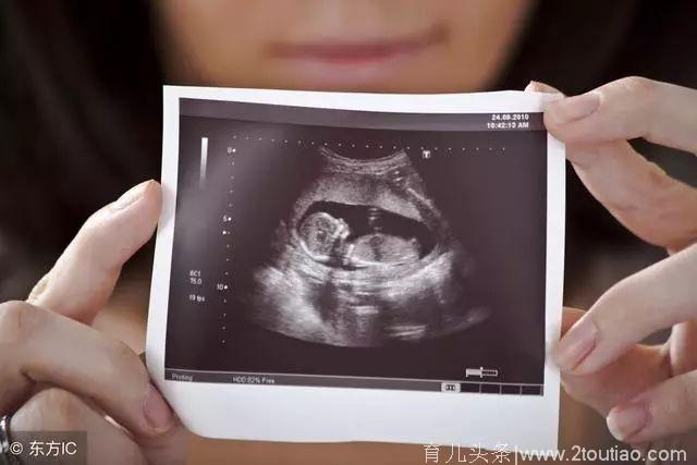 孕检时明明是女孩，生出来却是男孩？为什么会有这样的误差？