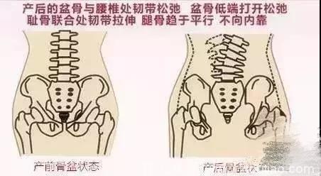 产后想重生，不管顺产还是剖腹产，坚持8方面，并且甩掉松弛肚子