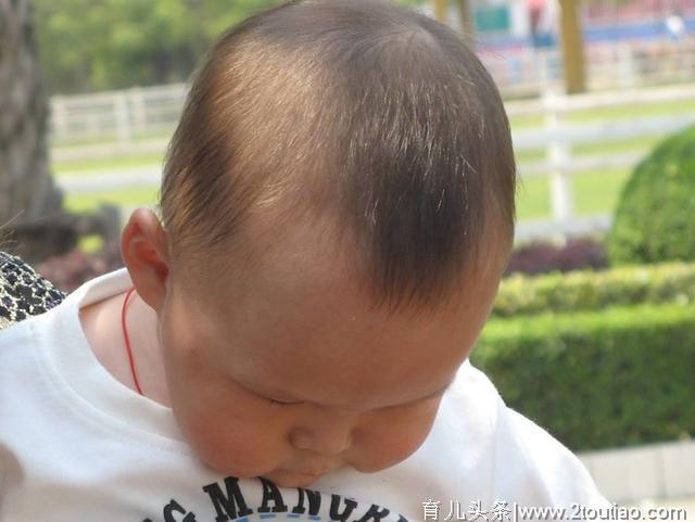 如何通过宝宝的头发问题，判断宝宝的健康问题？