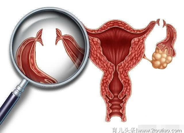 关于宫外孕，这3个原因女人应该知道，作为男人更要反省！