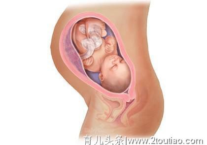 这4类孕妇不要执意顺产，容易伤到胎儿，早知道早脱险