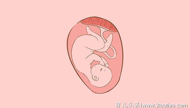 这4类孕妈分娩时，“开指”速度比常人快，更容易顺产