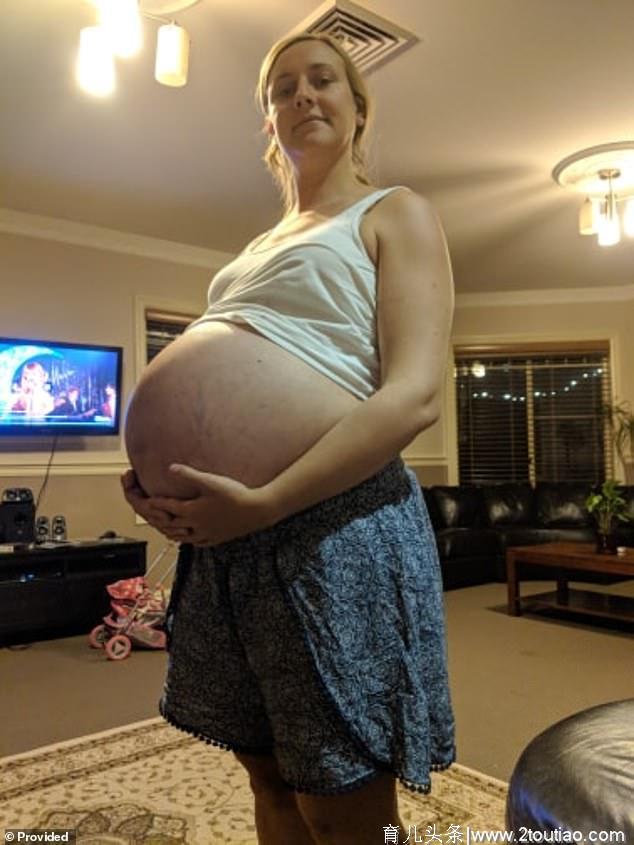 澳洲女子自然分娩仨巨婴 平均体重超5公斤