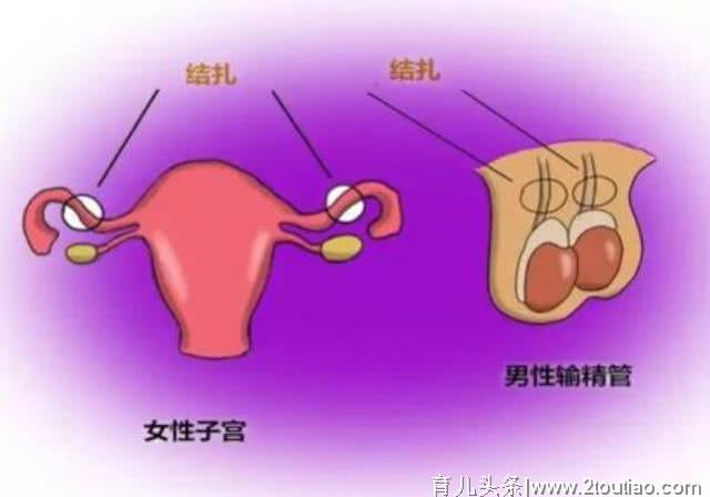 若不打算要孩子，哪一种避孕方式，既可靠又健康？看完就知道了！