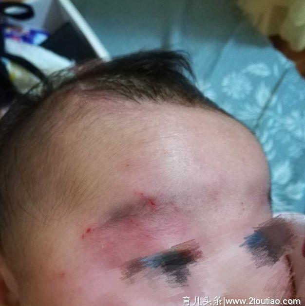 未满月儿子遭4岁侄女殴打！妈妈却只能忍着还不让去医院……