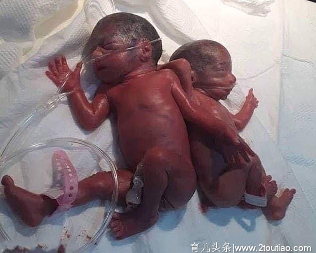 一次生完7胞胎！25岁年轻妈妈成功自然分娩，全世界都献上祝福