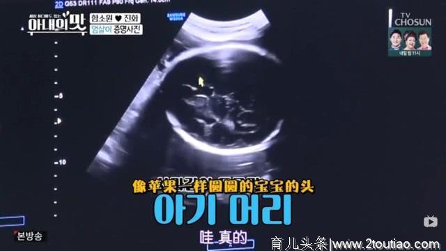韩国媳妇生子难顺产，产前痛哭不止好可怜，高龄产妇不容易