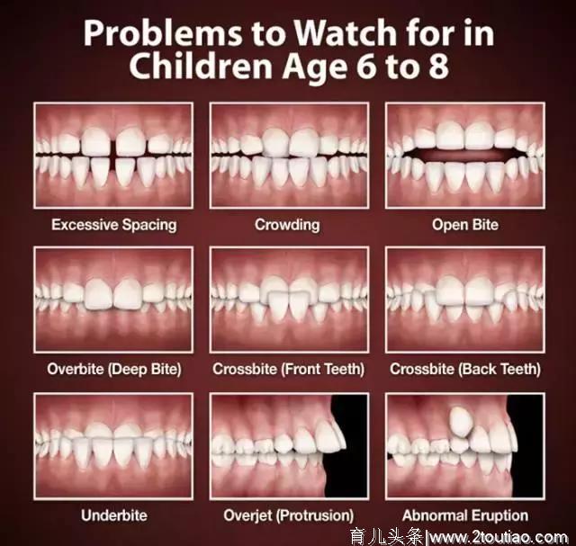 宝宝换牙很重要，这份攻略送给各位家长，为了宝宝的健康还请注意