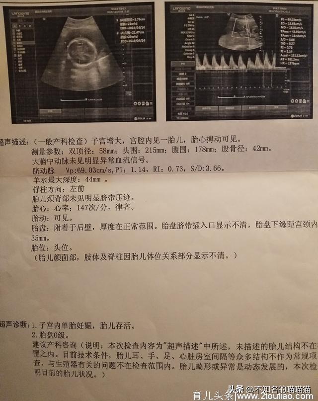 孕期的N次产检，纯属个人经验，仅供参考