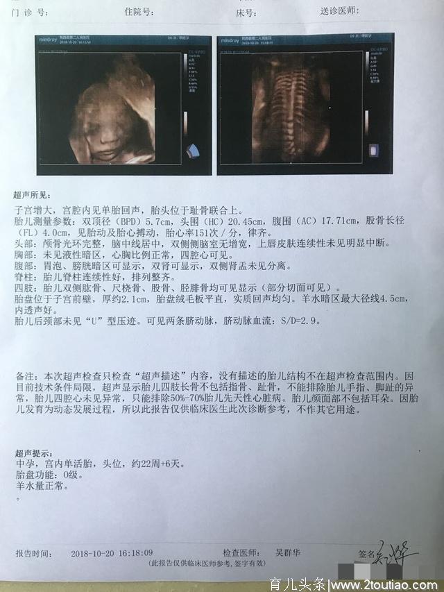 凌晨顺产6斤小公举一枚，我的孕期反应跟生娃过程