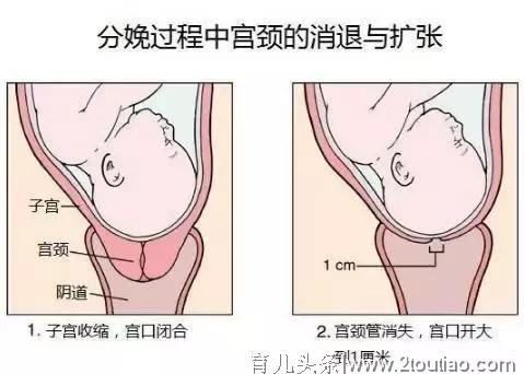 分娩中“开十指”是什么意思？-附图，看完你会更心疼妈妈的不易