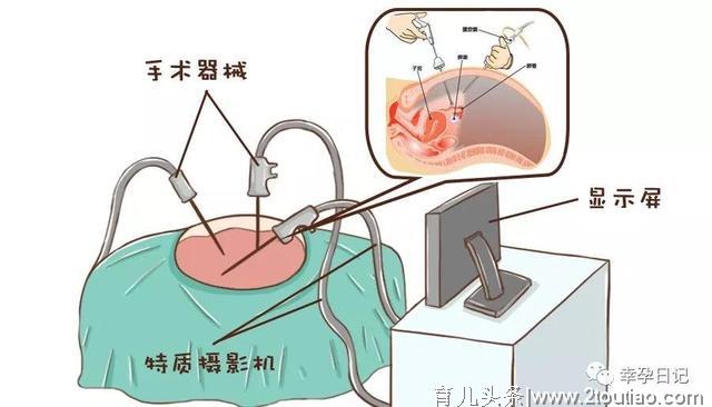 如果你在备孕路上遇到了子宫内膜异位症，该怎么办