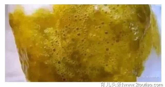 宝宝怎么样的大便才是正常、健康的呢？快来对照一下吧！