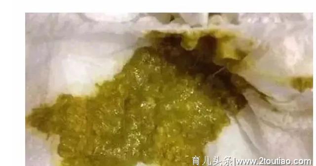 宝宝怎么样的大便才是正常、健康的呢？快来对照一下吧！