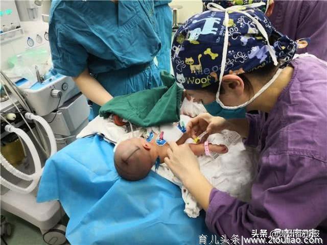 新生儿在分娩中意外坠地致颅内出血 创下开颅手术最年幼纪录