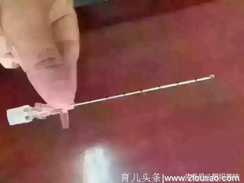 剖腹产在打麻醉药后，产妇都有什么感觉，看经历过的妈妈怎么说的