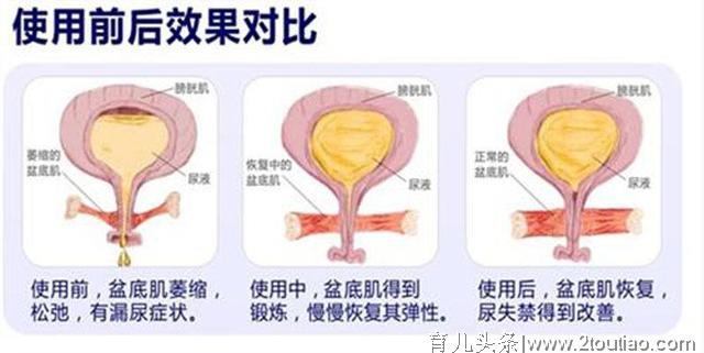 产后注意事项大全-产后检查不是可有可无，新妈妈千万别忽视